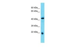 ABHD4 Rabbit anti-Rat, Polyclonal, Novus Biologicals 0.1ml; Unconjugated:Antibodies,